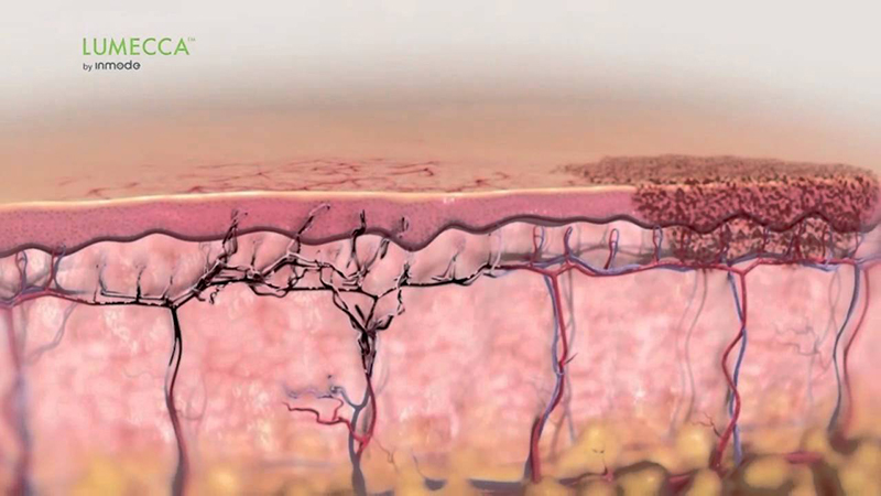 Image of skin layers